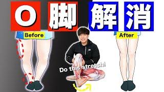 Stretch for 'Bowlegs That Hinder You From Losing Leg Fats' '#2 Weeks Bowleg Improvement Challenge'