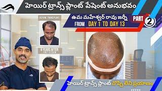 Hair Transplant In Hyderabad | Best Surgeon Center & Results Of Hair Transplant Surgery In Hyderabad