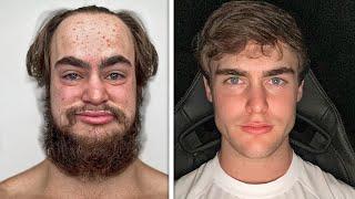 I'm an ugly guy that tried 'Looksmaxxing' for 7 Days