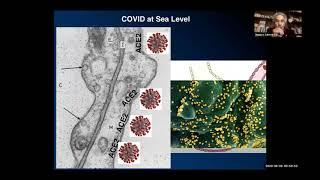 Pneumolysis and Silent Hypoxemia in COVID-19 by Prof. Dr. Gustavo Zubieta-Calleja