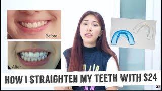 How I straighten my teeth with only $24 (Really effective)