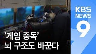 [앵커의 눈] ‘게임 중독’ 뇌 구조도 바꾼다…조기 치료 중요 / KBS뉴스(News)