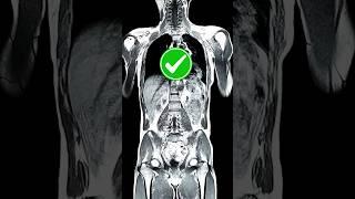 X-Ray vs CT-scan vs MRI