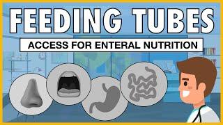 Types of Feeding Tubes EXPLAINED