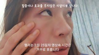 #눈물점제거#눈밑점제거#멜라논크림(멜라논크림 25일차 솔직리뷰)