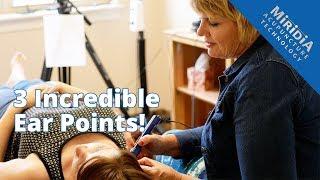 3 Powerful Ear Acupuncture Points that Enhance any Treatment