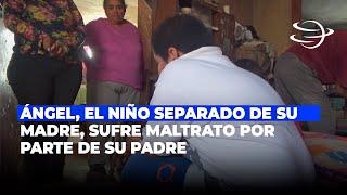 Ángel, el niño separado de su madre, sufre maltrato por parte de su padre