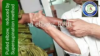 Pulled elbow Reduction | Supersupination | Nurse maid's elbow | Adamya Hospital Videos