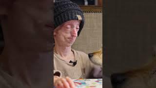 My progeria does not define me  #truly #borndifferent #progeria #rapidaging #rarecondition #ytshort