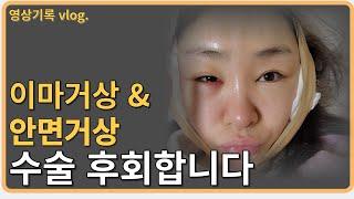 이마거상 안면거상수술 동시에 받았더니 ㅣ 수술직후부터 + 8일차까지의  리얼영상vlog ㅣ 광고 X