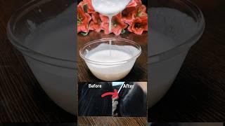 Dandruff treatment at home | Remove dandruff in one wash | Dandruff hair mask #haircare #shorts #yt