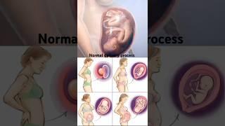normal delivery process in few seconds #baby #pregnant #women