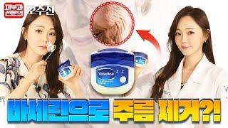 (SUB)3천원(Vaseline)으로 주름제거? 피부과의사가 직접 검증 !  피부 좋아지는 방법 ! 주름없애는 법 !