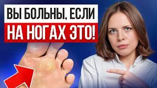 СЕКРЕТЫ диагностики по стопам — проверь себя за 5 минут!