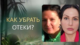 Как убрать отеки? Практика от отеков