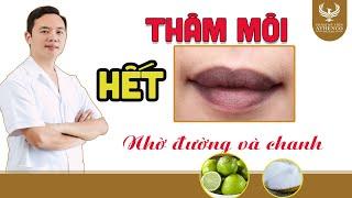 Điều trị thâm môi với Chanh và đường |điều trị thâm môi | Dr Thanh Hải