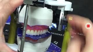 SETTING UPPER DENTURE TEETH