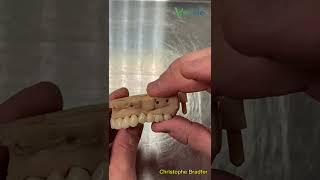 Testing Dentures ▏Vsmile