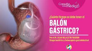 ¿Cuánto tiempo se debe tener colocado el balón gástrico?