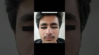 Before After Results | Dr. Rupali Pawar Suryawanshi