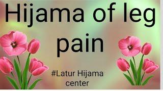 Hijama of leg pain | Latur Hijama center