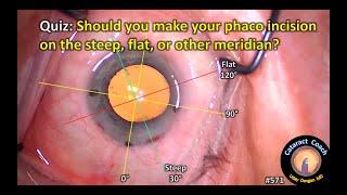 Cataract Quiz: On which meridian should you make the phaco incision?