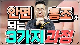 안면홍조 시리즈1편주사(안면홍조)가 되는 3가지 과정 얼굴습진 혈관염증 감성홍조 기저질환