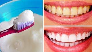 10 Natural Ways to Whiten Teeth at Home