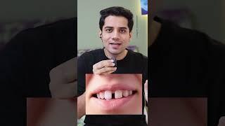 Daanto me gap hai? #shivammalik