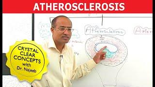 Atherosclerosis | Pathophysiology