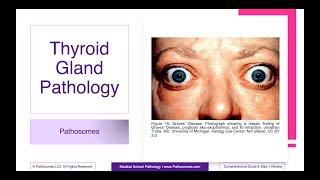 Thyroid Gland Pathology | Comprehensive Guide & Step 1 Review | Pathology Step 1 USMLE