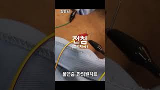 불면증으로 한의원에서 치료 받을 때, 어떤 치료를 받을까?