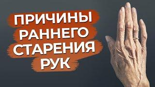 Морщины на руках – ЭТО СТАРОСТЬ? / Как сохранить руки молодыми?