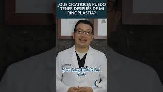 ¿Que cicatrices puede tener después de mi #Rinoplastia? | PlasticFacial MX