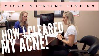 Micro Nutrient Testing CLEARED MY ACNE! l Rachel Scheer and Tawna Eubanks