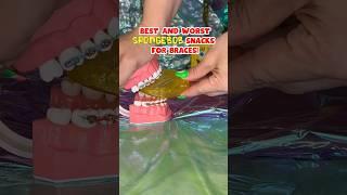 3 SPONGEBOB SNACKS to AVOID with BRACES *what to eat instead #braces #spongebob #snacks