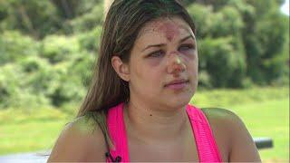 Woman viciously attacked while tubing near New Braunfels