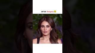 Radhika madan after surgery#shorts #radhikamadan #bollywood #transformation #plasticsurgery