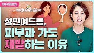 성인여드름, 끝없이 재발하는 이유! ::피부진심 닥터찐