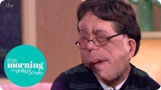 Adam Pearson Talks About Judging People By Their Looks | This Morning