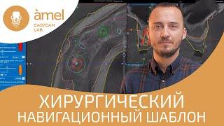Хирургический навигационный шаблон в Bauers CAD/CAM Lab