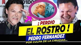 Pedro Fernández QUEDO DESFIGURADO tras cirugías plásticas en EL ROSTRO