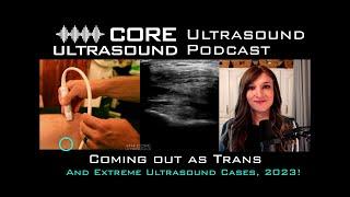 Coming out as Trans and Extreme Ultrasound Cases, 2023!