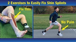 NO MORE Shin Splits - Run With Out Pain. The Complete Cure!!