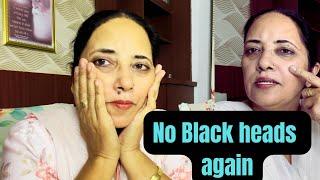 ਬਲੈਕਹੈਡ,ਵਾਈਟਹੈਡ ਜੜ ਤੋਂ ਖਤਮ,Remove blackheads and whiteheads naturally