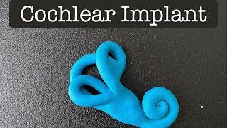 Playdough Surgery - Cochlear Implant