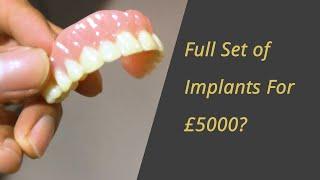 Full Set of Dental Implants For £5000?!?