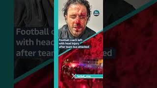 French #football fans left a manager bloodied and bandaged after attacking a team bus #itvnews #lyon