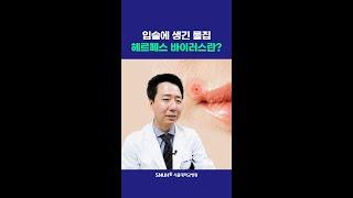 입술에 생긴 물집, 헤르페스 바이러스란?