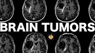 Brain Tumors